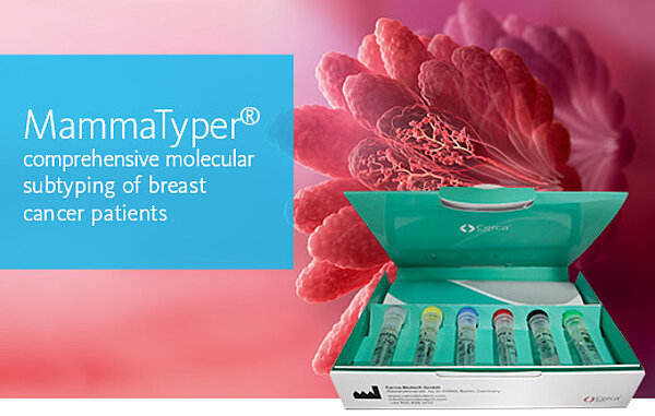 MammaTyper® comprehensive molecular subtyping of breast cancer patients