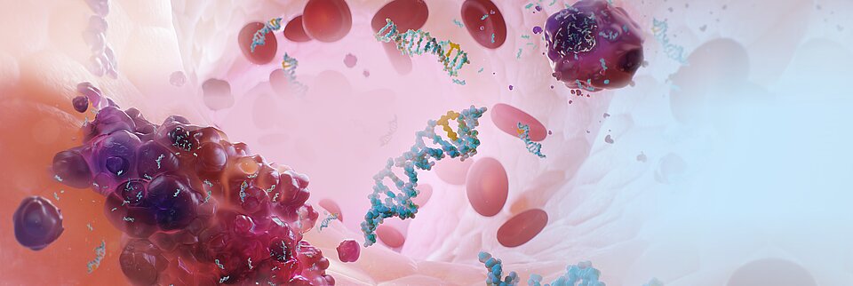 Liquid Biopsy with Plasma-SeqSensei