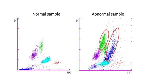 Scattergram