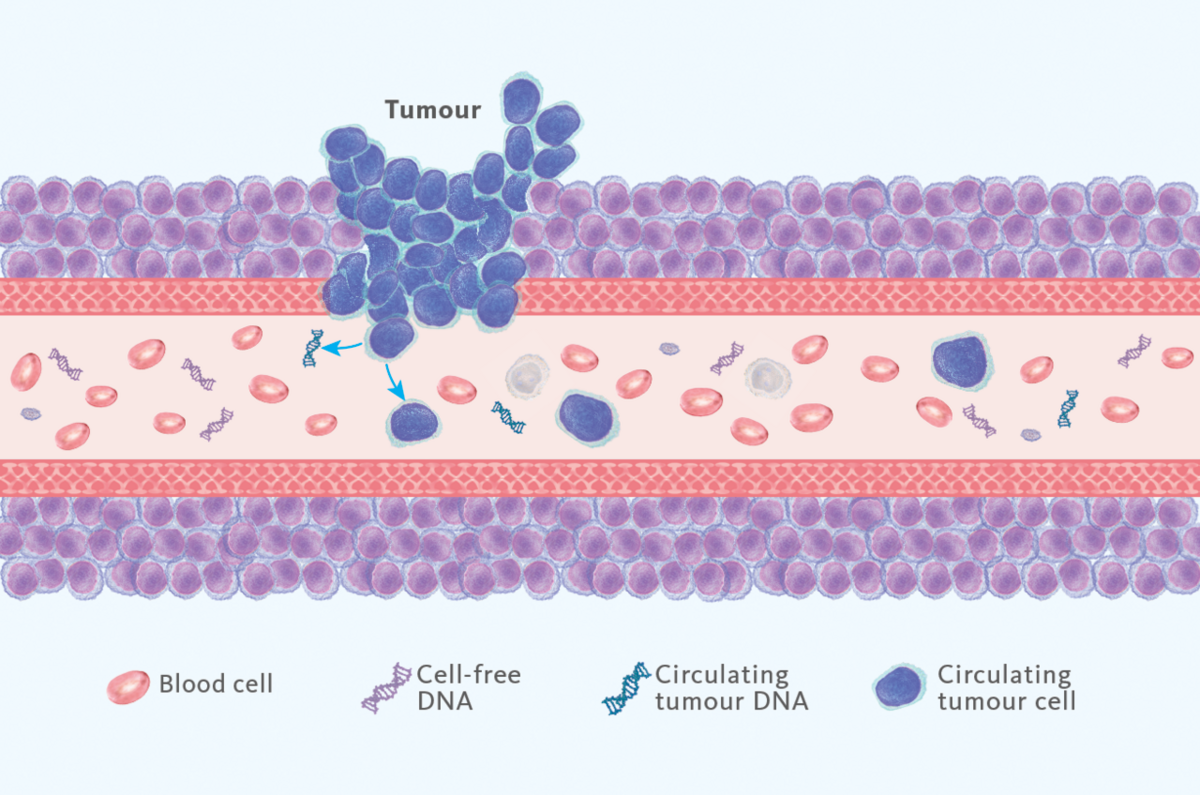 Liquid biopsy