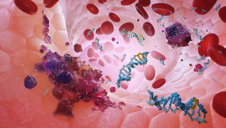 Liquid Biopsy with Plasma-SeqSenseiTM