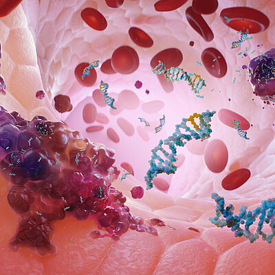 Liquid Biopsy with Plasma-SeqSenseiTM