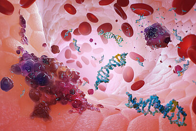 Liquid Biopsy with Plasma-SeqSenseiTM