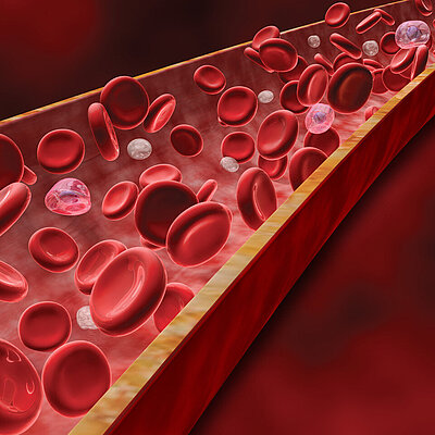 Webinar: Anaemia management in the context of Patient Blood Management in surgical patients