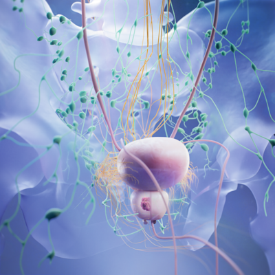 Prostate cancer