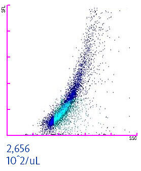 WDF Scattergram