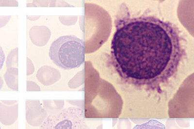 Sysmex Cellspotting Quiz