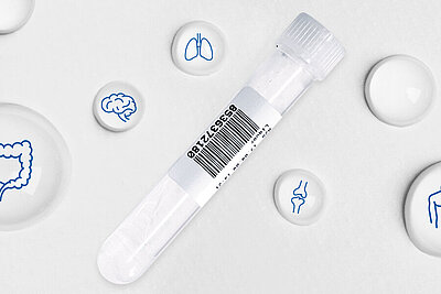 Integrate body fluid cell analysis