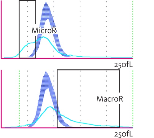 RBC histogram with indication of MicroR and MacroR