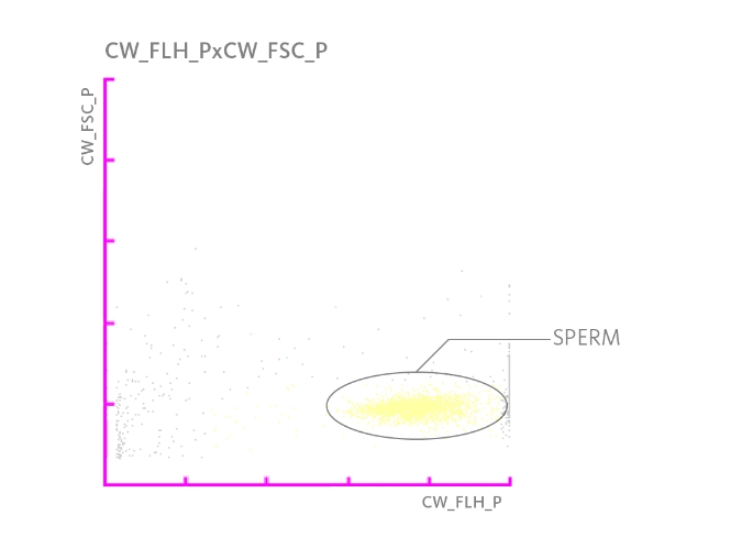 Scattergram highlighting a population spermatozoa in a urine sample.