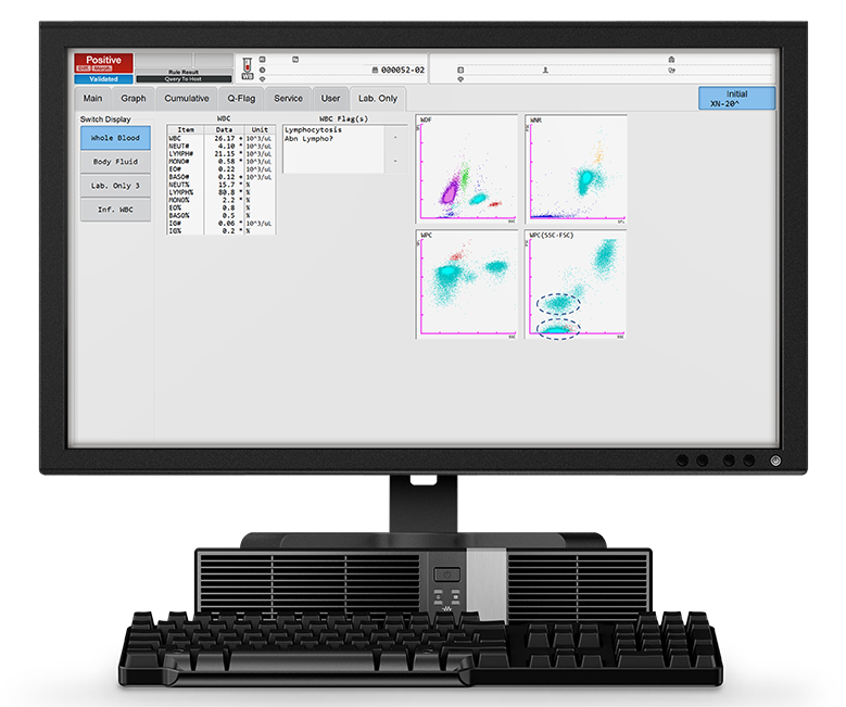 Fig. 1 The XN IPU “Lab. Only” screen shows the differential count and the WDF, WNR and WPC scattergrams