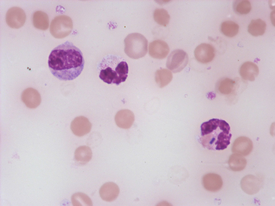 Clostridium perfringens Clostridium perfringens