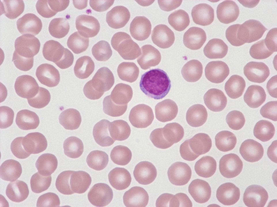 Red blood cells and lymphocyte