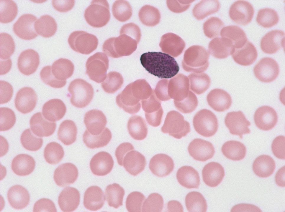 Pollen in blood film