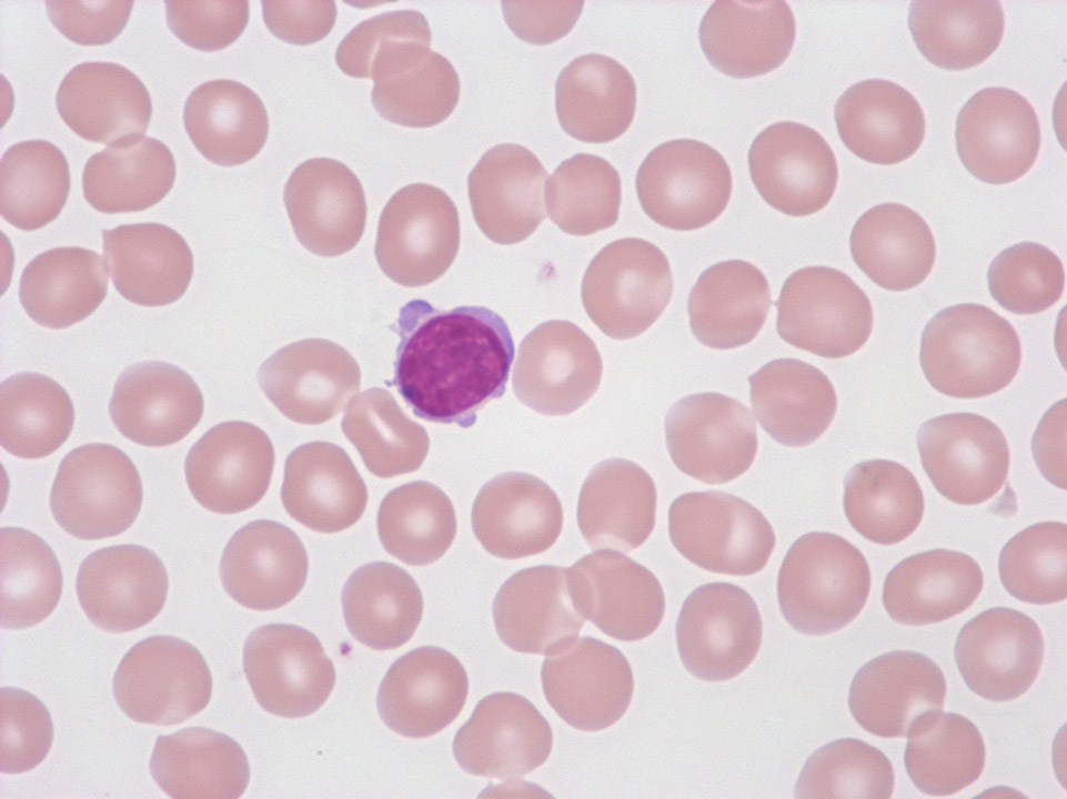 Cytoplasmic protrusions of a lymphocyte Cytoplasmic protrusions of a lymphocyte