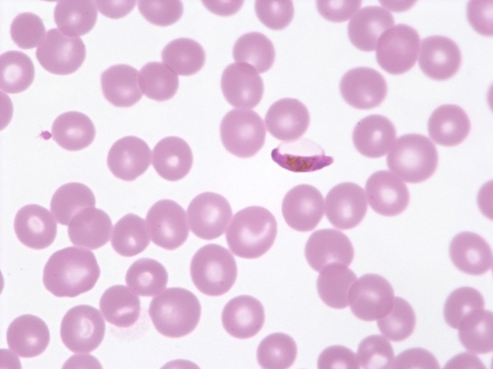 Gametocyte