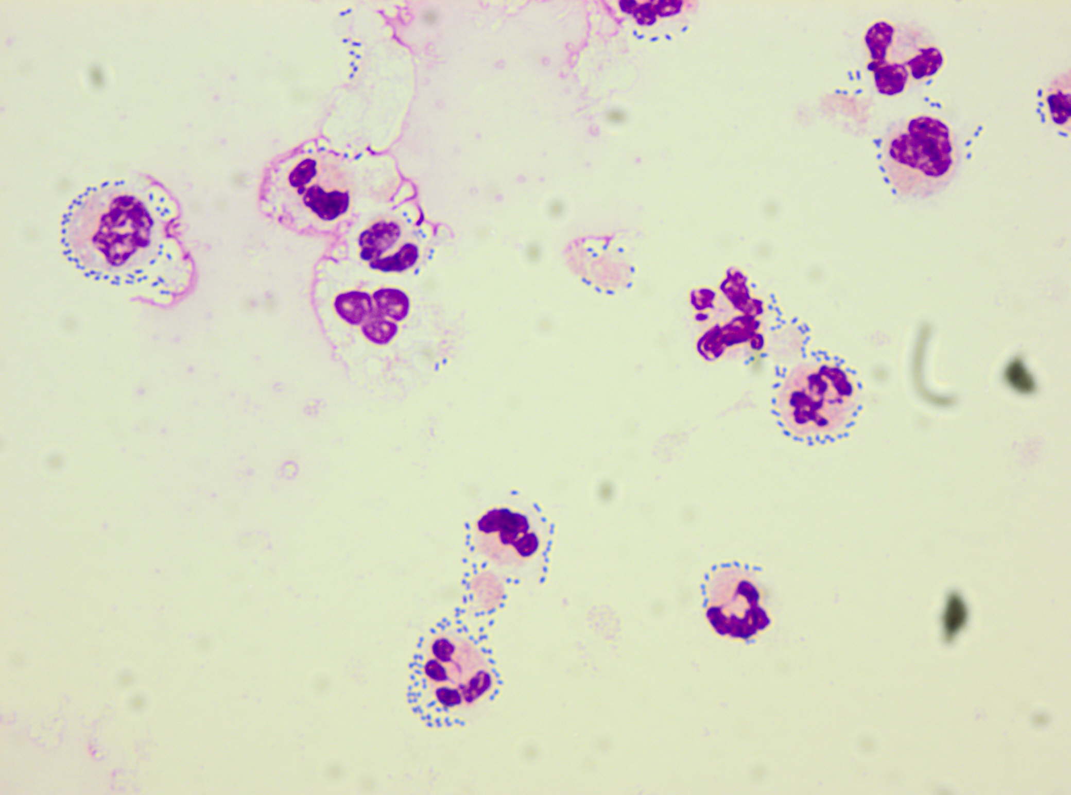 CSF with bacteria