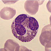 Eosinophil Eosinophil
