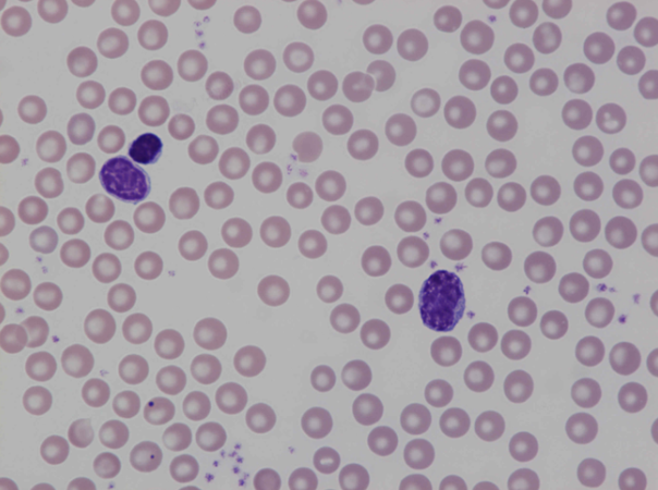 Murine (mouse) lymphocytes and erythroblast