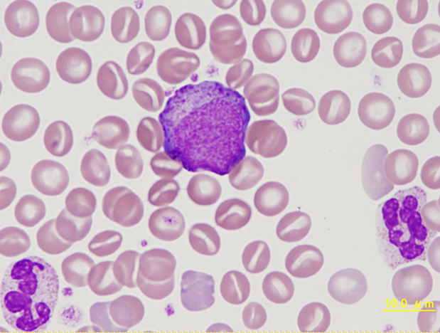 NHP myelocyte