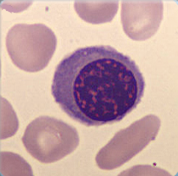 Nucleated Red Blood Cell