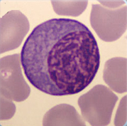 Plasma cell Plasma cell