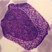 Promyelocyte Promyelocyte