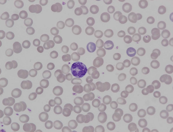 Murine (rat) red blood cell morphology II