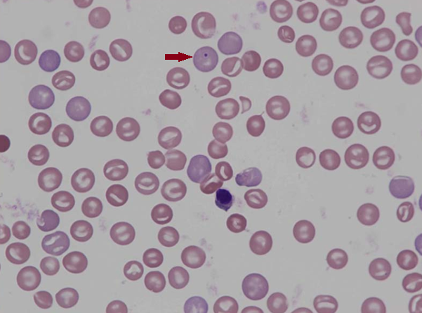 Murine (rat) red blood cell morphology III