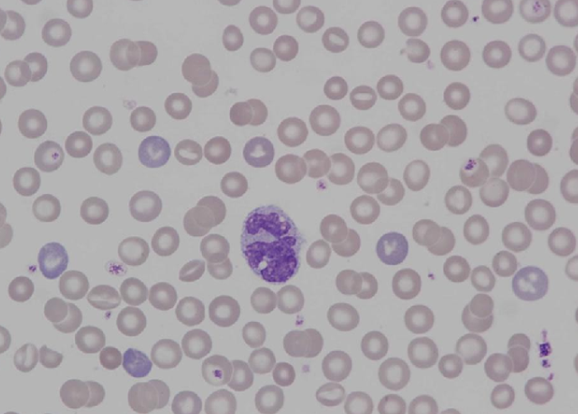 Murine (rat) – anaemia / polyploidy