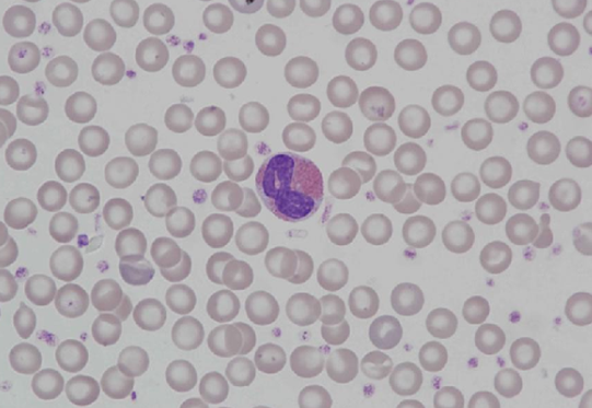 Murine (rat) eosinophil