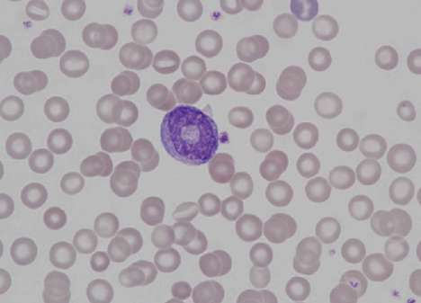 Murine (rat) metamyelocyte